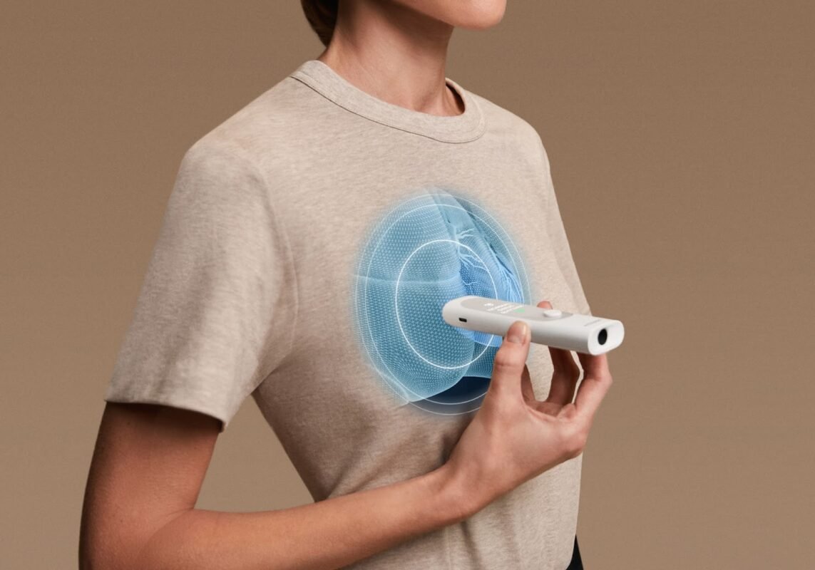 The medical tricorder from Withings BeamO