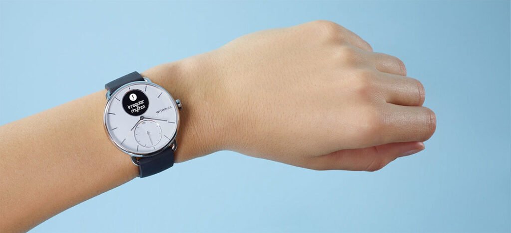 WITHINGS SCAN WATCH  THE GRAIL OF E-HEALTH