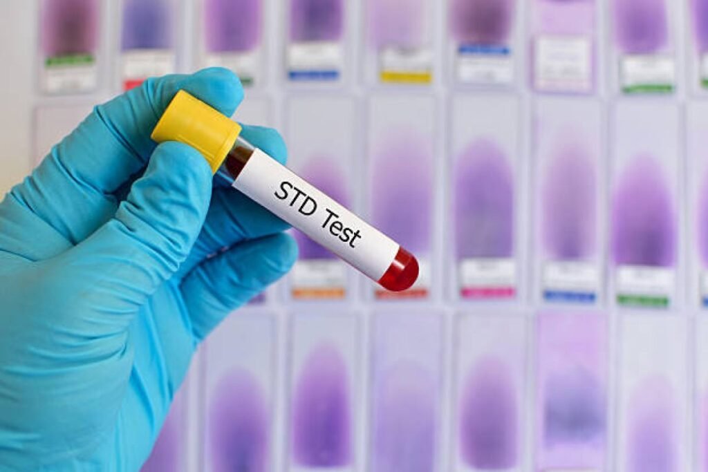 Where to get STD testing?All you should to know about STD testing online & offline